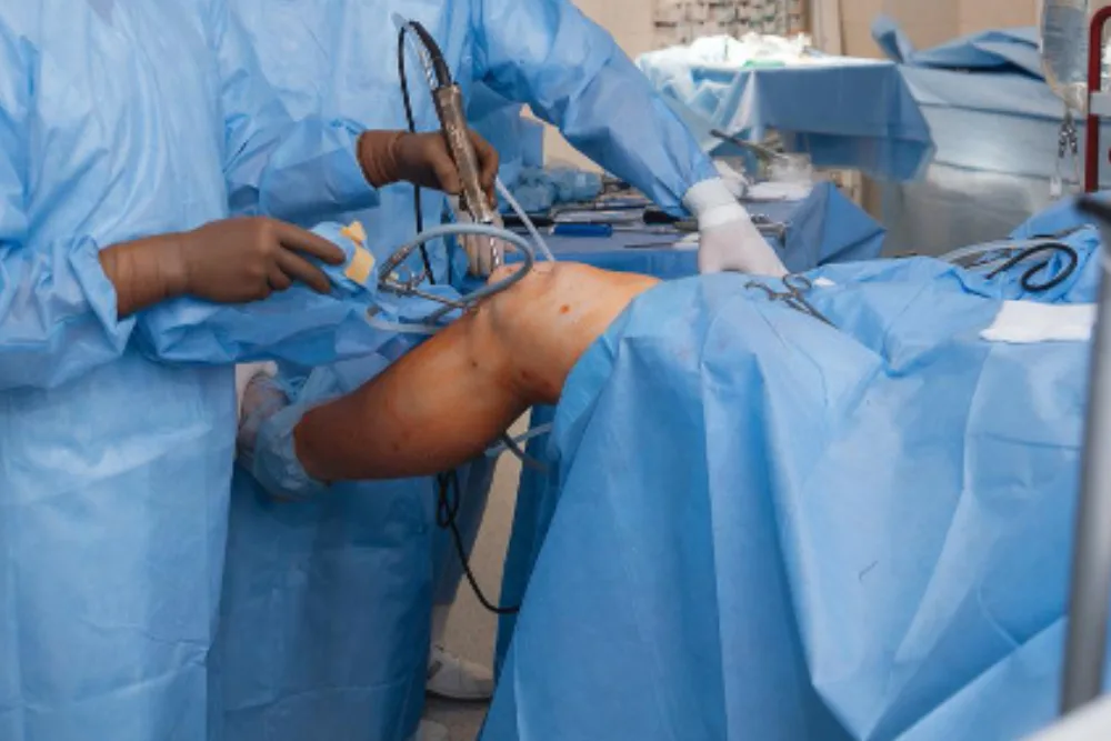 Reconstrucción del ligamento cruzado anterior (LCA)